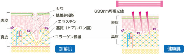 �R���[�Q���E�G���X�`���̐������i�C���[�W